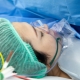 General anesthesia for caesarean section