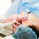 How long is the cesarean section and how does the duration of the operation depend?