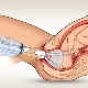 Application of vacuum during childbirth