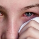 Psychosomatic causes of conjunctivitis in children and adults