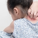 Psychosomatic causes of psoriasis in children and adults