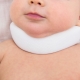 Signs and symptoms of torticollis in newborns and infants