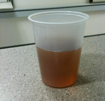 Pink urine