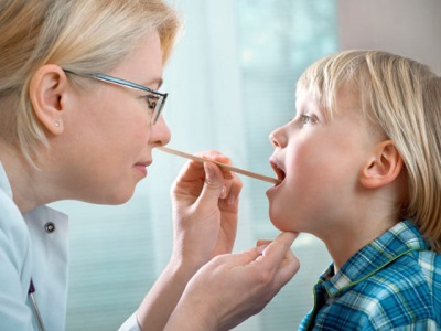 Thrush in a child's mouth