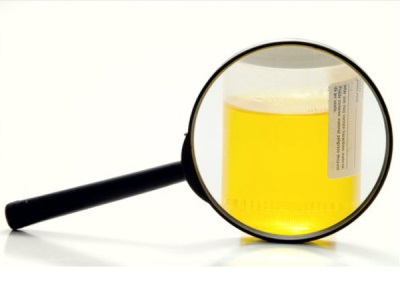 Analysis of urine